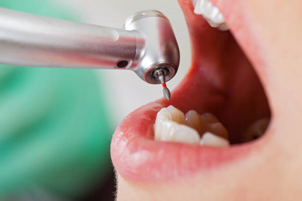 Best Dentist for Tooth Abscess  in Rocky River, OH